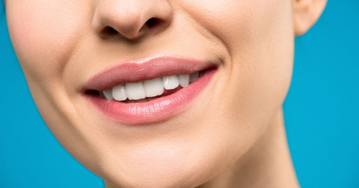 Hollywood Smile